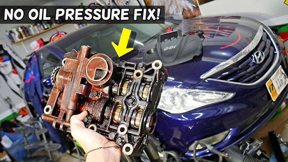 hyundai sonata oil pressure sensor error code